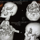 Illustration for article titled Excuse Me, Sir, But You Have A Rather Large Knife In Your Skull